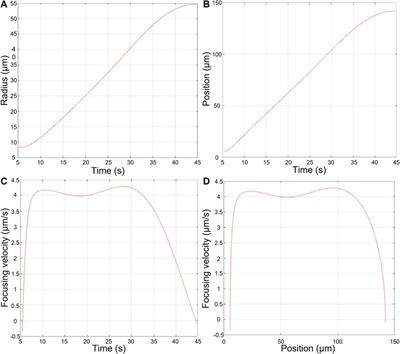 Characterization of mesenchymal stromal cells physical properties using acoustic radiation force